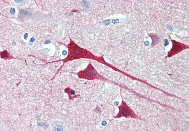 Anti-Neurogranin antibody, Internal used in IHC (Paraffin sections) (IHC-P). GTX88301