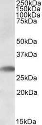 Anti-TREML1 antibody, C-term used in Western Blot (WB). GTX88375