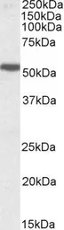 Anti-5-HT3B receptor antibody, Internal (near C-terminus) used in Western Blot (WB). GTX88391