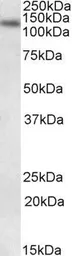 Anti-DNA ligase I antibody, Internal (near C-Terminus) used in Western Blot (WB). GTX88393