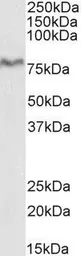Anti-XPNPEP1 antibody, C-term used in Western Blot (WB). GTX88401