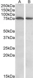Anti-STK39 antibody, Internal used in Western Blot (WB). GTX88403