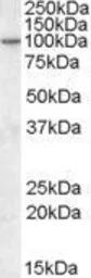 Anti-CENTG1 antibody, Internal used in Western Blot (WB). GTX88422