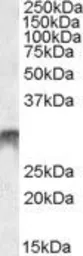Anti-DLX5 antibody, Internal used in Western Blot (WB). GTX88434