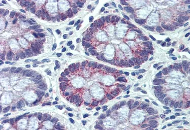 Anti-PXR antibody, Internal used in IHC (Paraffin sections) (IHC-P). GTX88474