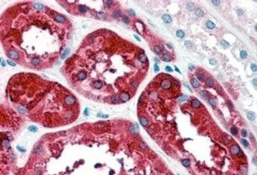 Anti-Ferritin Heavy chain antibody, C-term used in IHC (Paraffin sections) (IHC-P). GTX88497