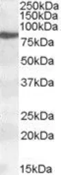 Anti-ALOX15 antibody, Internal used in Western Blot (WB). GTX88501