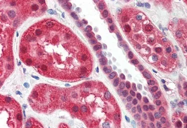 Anti-ALOX15 antibody, Internal used in IHC (Paraffin sections) (IHC-P). GTX88501