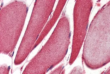 Anti-ALOX15 antibody, Internal used in IHC (Paraffin sections) (IHC-P). GTX88501