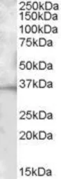 Anti-CD272 antibody, C-term used in Western Blot (WB). GTX88506
