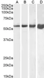 Anti-Desmin antibody, C-term used in Western Blot (WB). GTX88510