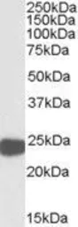 Anti-PRX I antibody, Internal used in Western Blot (WB). GTX88526
