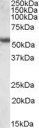 Anti-Cytokeratin 13 antibody, C-term used in Western Blot (WB). GTX88529