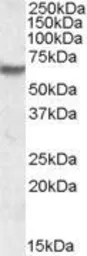 Anti-IMPDH2 antibody, Internal used in Western Blot (WB). GTX88543
