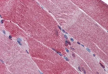 Anti-PACE4 antibody, Internal used in IHC (Paraffin sections) (IHC-P). GTX88546