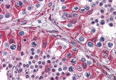 Anti-PACE4 antibody, Internal used in IHC (Paraffin sections) (IHC-P). GTX88546