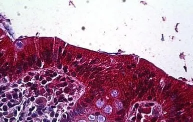 Anti-LRP4 antibody, Internal used in IHC (Paraffin sections) (IHC-P). GTX88580