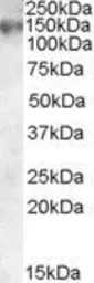 Anti-MRP1 antibody, Internal used in Western Blot (WB). GTX88617