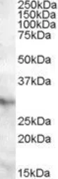 Anti-APOA1BP antibody, C-term used in Western Blot (WB). GTX88646