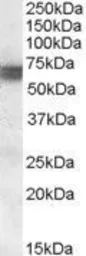 Anti-BIN1 antibody, Internal used in Western Blot (WB). GTX88650