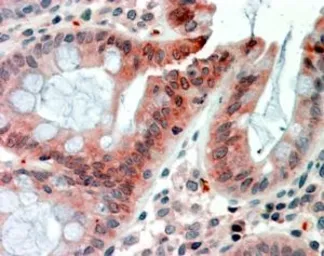 Anti-RELM beta antibody, Internal used in IHC (Paraffin sections) (IHC-P). GTX88677