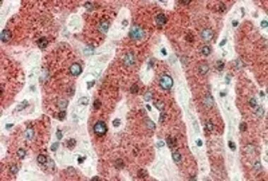 Anti-HRASLS2 antibody, Internal used in IHC (Paraffin sections) (IHC-P). GTX88686