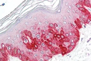 Anti-ATG16L1 antibody, Internal used in IHC (Paraffin sections) (IHC-P). GTX88747