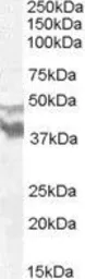 Anti-DYX1C1 antibody, N-term used in Western Blot (WB). GTX88749