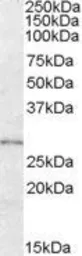 Anti-LYPLAL1 antibody, Internal used in Western Blot (WB). GTX88793