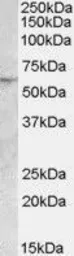 Anti-ATGL antibody, Internal used in Western Blot (WB). GTX88804