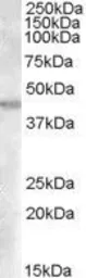 Anti-GOT2 (aa 295 to 306) antibody, Internal used in Western Blot (WB). GTX88853