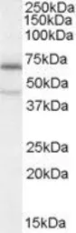 Anti-C14orf169 / NO66 antibody, Internal used in Western Blot (WB). GTX88860