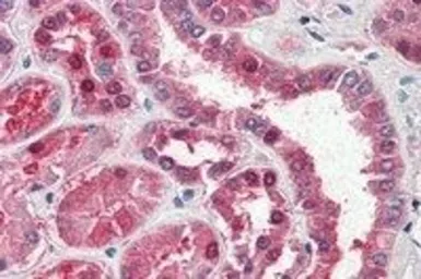 Anti-GOT1 (aa 157-167) antibody, Internal used in IHC (Paraffin sections) (IHC-P). GTX88870