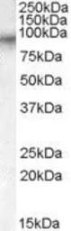 Anti-Factor XIIIa (703-717) antibody, Internal used in Western Blot (WB). GTX88886