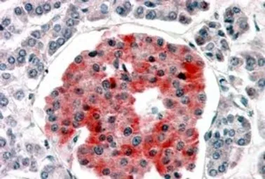 Anti-Kir6.2 antibody, Internal (near the N-term) used in IHC (Paraffin sections) (IHC-P). GTX88908
