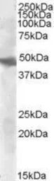 Anti-GOT2 (aa 360 to 373) antibody, Internal used in Western Blot (WB). GTX88925