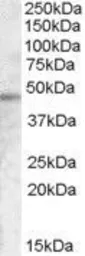 Anti-TMPRSS3 antibody, Internal used in Western Blot (WB). GTX88931