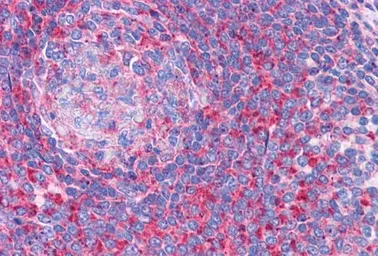 Anti-TPD52L2 antibody, C-term used in IHC (Paraffin sections) (IHC-P). GTX88975