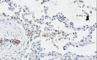Anti-TREM2 antibody, C-term used in IHC (Paraffin sections) (IHC-P). GTX89017