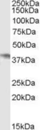 Anti-NCF4 antibody, Internal used in Western Blot (WB). GTX89030