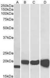 Anti-SOD1 antibody, Internal used in Western Blot (WB). GTX89049