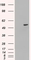 Anti-PAX8 antibody, Internal used in Western Blot (WB). GTX89084