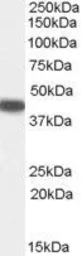 Anti-SerpinB9 antibody, Internal used in Western Blot (WB). GTX89125