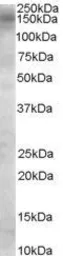 Anti-AS160 / TBC1D4 antibody, Internal used in Western Blot (WB). GTX89152