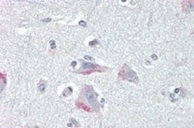 Anti-CRHR1 (aa 250 - 263) antibody, Internal used in IHC (Paraffin sections) (IHC-P). GTX89157