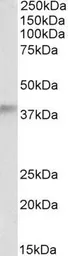 Anti-ADH5 antibody, Internal used in Western Blot (WB). GTX89162
