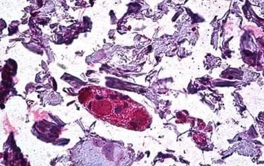 Anti-DGAT1 antibody, Internal used in IHC (Paraffin sections) (IHC-P). GTX89164