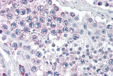 Anti-GPSM2 antibody, Internal used in IHC (Paraffin sections) (IHC-P). GTX89175