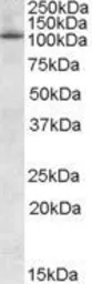 Anti-OSBPL5 antibody, N-term used in Western Blot (WB). GTX89176