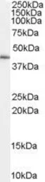 Anti-GATA5 antibody, Internal used in Western Blot (WB). GTX89189